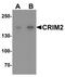 Kielin Cysteine Rich BMP Regulator antibody, TA326631, Origene, Western Blot image 