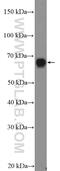 Guanylate Binding Protein 1 antibody, 15303-1-AP, Proteintech Group, Western Blot image 