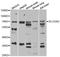 Solute carrier family 23 member 2 antibody, LS-C334917, Lifespan Biosciences, Western Blot image 