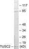 Tumor Suppressor 2, Mitochondrial Calcium Regulator antibody, EKC1654, Boster Biological Technology, Western Blot image 