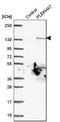 Pleckstrin Homology Domain Containing A7 antibody, NBP1-85045, Novus Biologicals, Western Blot image 