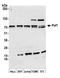 PAF1 Homolog, Paf1/RNA Polymerase II Complex Component antibody, A300-172A, Bethyl Labs, Western Blot image 