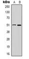 BRCA1/BRCA2-Containing Complex Subunit 3 antibody, orb74882, Biorbyt, Western Blot image 