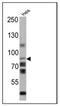 CD44 antibody, NBP2-22530, Novus Biologicals, Western Blot image 