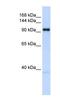 O-Linked N-Acetylglucosamine (GlcNAc) Transferase antibody, NBP1-52925, Novus Biologicals, Western Blot image 
