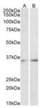 CCAAT Enhancer Binding Protein Beta antibody, NBP2-26206, Novus Biologicals, Western Blot image 