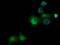 Pantothenate kinase 2, mitochondrial antibody, GTX83946, GeneTex, Immunocytochemistry image 