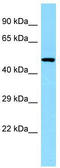 Cytokine-dependent hematopoietic cell linker antibody, TA337939, Origene, Western Blot image 