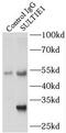 Sulfotransferase Family 1E Member 1 antibody, FNab08382, FineTest, Immunoprecipitation image 