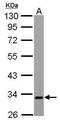 Electron transfer flavoprotein subunit alpha, mitochondrial antibody, GTX105155, GeneTex, Western Blot image 
