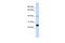 Selenoprotein S antibody, A04386, Boster Biological Technology, Western Blot image 
