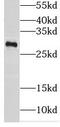 Glutathione S-Transferase Theta 2 (Gene/Pseudogene) antibody, FNab03701, FineTest, Western Blot image 