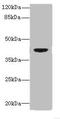 Death Associated Protein Kinase 2 antibody, A50185-100, Epigentek, Western Blot image 