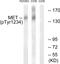 c-met antibody, LS-C117416, Lifespan Biosciences, Western Blot image 