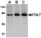 Protein Tyrosine Kinase 7 (Inactive) antibody, AHP1440, Bio-Rad (formerly AbD Serotec) , Western Blot image 