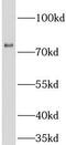 MX Dynamin Like GTPase 1 antibody, FNab09996, FineTest, Western Blot image 