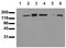 Receptor tyrosine-protein kinase erbB-3 antibody, AM00054PU-N, Origene, Western Blot image 