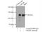 Ubiquitination Factor E4B antibody, 18148-1-AP, Proteintech Group, Immunoprecipitation image 