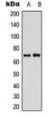 CDK5 and ABL1 enzyme substrate 1 antibody, LS-C354213, Lifespan Biosciences, Western Blot image 