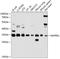 Microtubule Associated Protein RP/EB Family Member 1 antibody, A02070, Boster Biological Technology, Western Blot image 