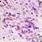 Chromodomain Y Like 2 antibody, LS-C353626, Lifespan Biosciences, Immunohistochemistry frozen image 