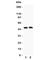AQP0 antibody, R31222, NSJ Bioreagents, Western Blot image 