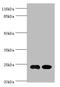 Nucleolar Protein 3 antibody, A56839-100, Epigentek, Western Blot image 