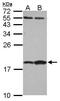 Fatty Acid Binding Protein 7 antibody, GTX121467, GeneTex, Western Blot image 