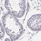 Ecto-NOX Disulfide-Thiol Exchanger 1 antibody, HPA038355, Atlas Antibodies, Immunohistochemistry frozen image 