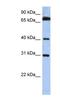 Dehydrogenase/Reductase X-Linked antibody, NBP1-79978, Novus Biologicals, Western Blot image 