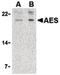 Amino-terminal enhancer of split antibody, PA5-20170, Invitrogen Antibodies, Western Blot image 