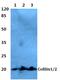 Cofilin 2 antibody, A04773T88, Boster Biological Technology, Western Blot image 