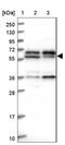 Coiled-Coil Domain Containing 9B antibody, NBP1-93764, Novus Biologicals, Western Blot image 