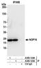 NOP16 Nucleolar Protein antibody, A305-125A, Bethyl Labs, Immunoprecipitation image 