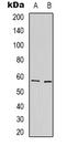 Sulfated glycoprotein 1 antibody, LS-B14263, Lifespan Biosciences, Western Blot image 