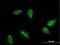 Ring Finger Protein 6 antibody, H00006049-M01, Novus Biologicals, Immunocytochemistry image 