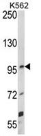 Unc-5 Netrin Receptor C antibody, AP17822PU-N, Origene, Western Blot image 