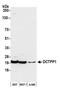 DCTP Pyrophosphatase 1 antibody, A305-795A-M, Bethyl Labs, Western Blot image 