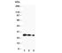 Lipocalin 2 antibody, R30452, NSJ Bioreagents, Western Blot image 