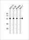 DIP antibody, M14911, Boster Biological Technology, Western Blot image 