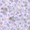 Epoxide Hydrolase 1 antibody, A2070, ABclonal Technology, Immunohistochemistry paraffin image 