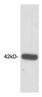 C-C Motif Chemokine Receptor 4 antibody, LS-C202989, Lifespan Biosciences, Western Blot image 