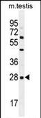C-Type Lectin Domain Family 12 Member B antibody, PA5-71556, Invitrogen Antibodies, Western Blot image 