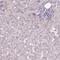 Gem Nuclear Organelle Associated Protein 2 antibody, PA5-61251, Invitrogen Antibodies, Immunohistochemistry paraffin image 