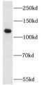 EPH Receptor A4 antibody, FNab02802, FineTest, Western Blot image 