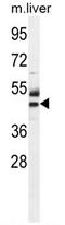 Cytosolic Thiouridylase Subunit 1 antibody, AP50309PU-N, Origene, Western Blot image 