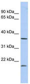 Methylenetetrahydrofolate Dehydrogenase (NADP+ Dependent) 2 Like antibody, TA335893, Origene, Western Blot image 