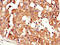 CRABP-II antibody, A62330-100, Epigentek, Immunohistochemistry paraffin image 