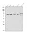 5'-Aminolevulinate Synthase 1 antibody, A10405-1, Boster Biological Technology, Western Blot image 