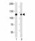 Discoidin Domain Receptor Tyrosine Kinase 2 antibody, F52890-0.4ML, NSJ Bioreagents, Western Blot image 